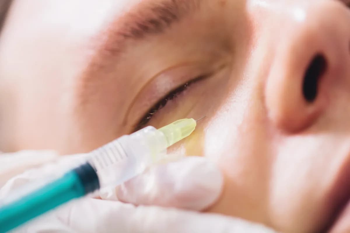 Dr. Mehmet Karakuyu Göz Altı Işık Dolgusu uygulaması